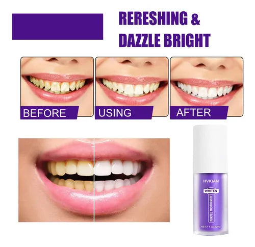 ¡Compra 1 y llévate 3! Blanqueamiento dental instantáneo